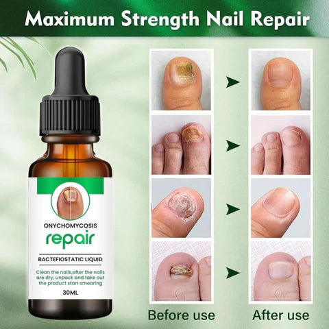 Nail Repair™ Organic Nail Growth and Protection Serum - BUY 1 GET 1 FREE
